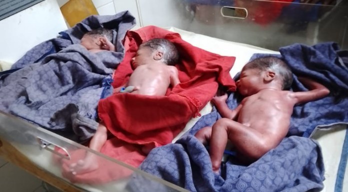 Woman gives birth to three girls simultaneously in Hazaribagh